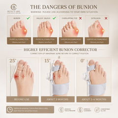 Painless Bunion Toe Corrector