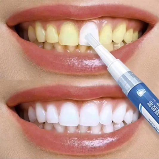 Dazzling Instant Teeth Whitening Pen
