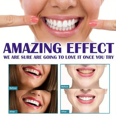 Dazzling Instant Teeth Whitening Pen